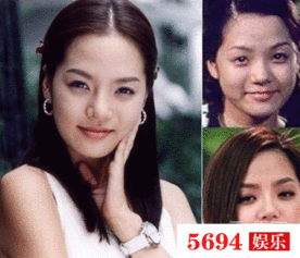 整容医院流出明星,明星整容真相，医院流出照片曝光惊人变化