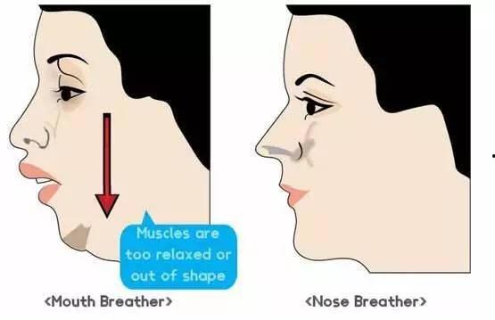 明星用嘴巴呼吸