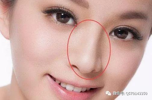 鼻子有痣的网红,揭秘鼻子有痣网红的逆袭之路